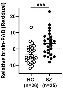 Peripheral inflammation levels associated with degree of advanced brain aging in schizophrenia